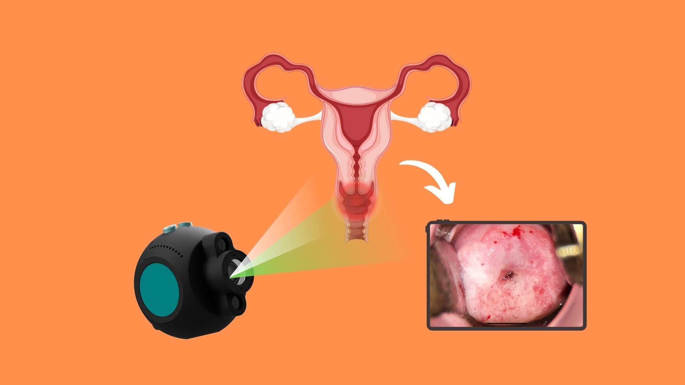 COLPOSCOPY